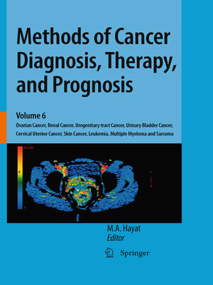cover image of Methods of Cancer Diagnosis, Therapy, and Prognosis